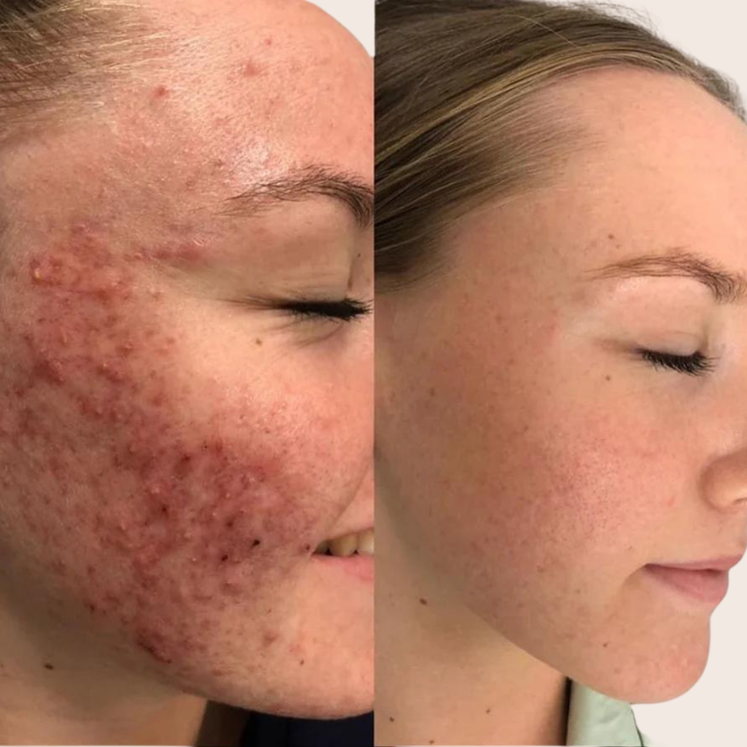 Esmi Hyaluronic Hydrating Serum
