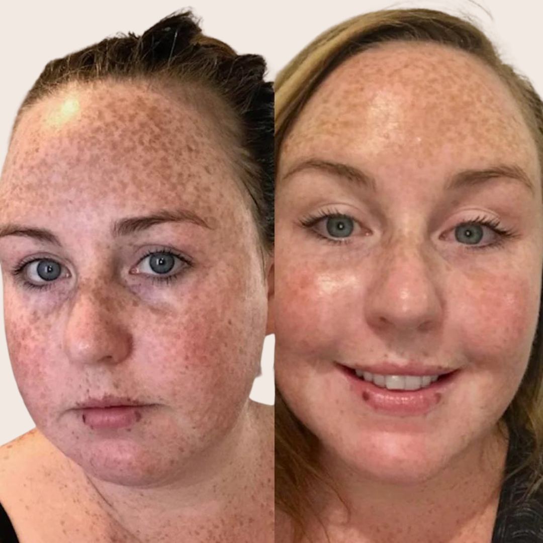 Pomegranate Brightening Serum