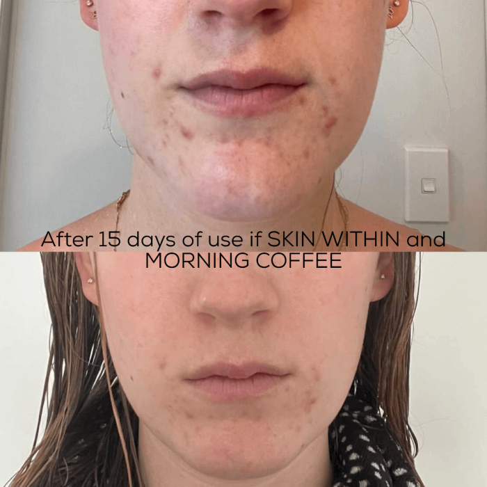 Skin Within Food Supplement