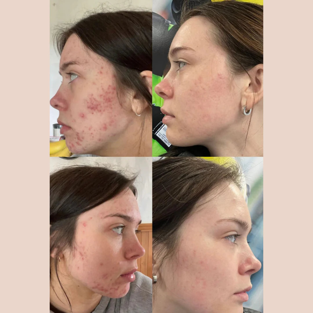 Skin Within Food Supplement