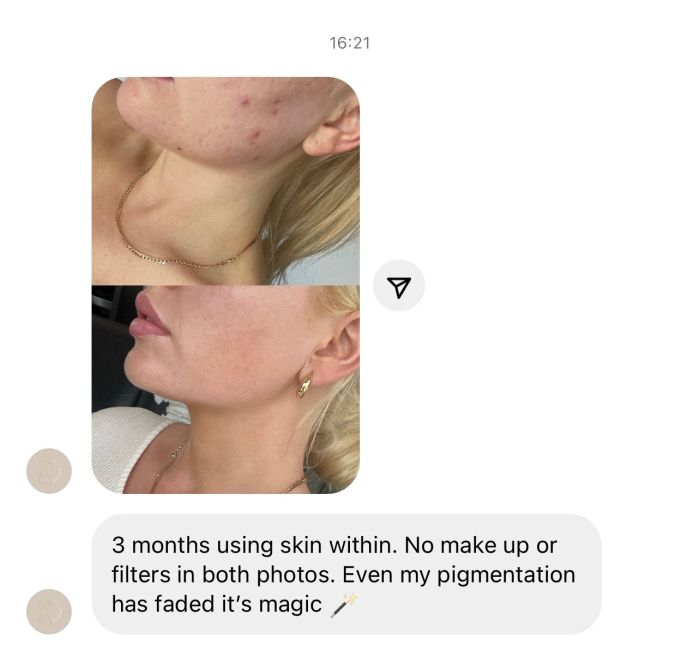 Skin Within Food Supplement